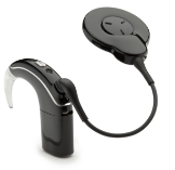 Soundprozessor  für Cochlea-Implantat  mit Smartphoneverbindung